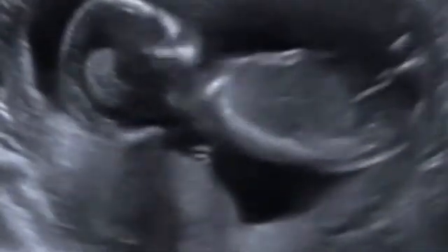 Image for chunk 7